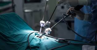 Laproscopic-Minimal Invasive Surgery in Bilaspur